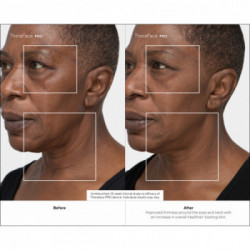 Therabody - TheraFace Pro Nero, la soluzione più avanzata per la salute del viso