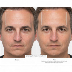 Therabody - TheraFace Pro Nero, la soluzione più avanzata per la salute del viso